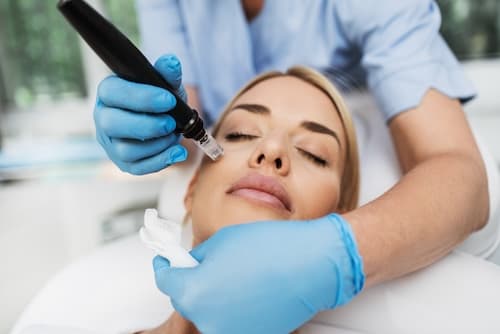 Tighten, Lift, and Firm: Scarlet RF Microneedling